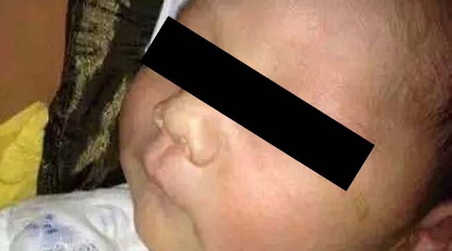 bebe cego por causa flash camera